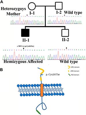 Loss-of-function variant in the LRR domain of SLITRK2 implicated in a neurodevelopmental disorder